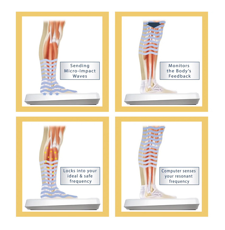 Juvent - How it works